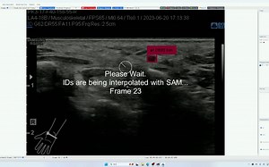 用 Labelme 标注医学图像太繁琐？试试“LabelAI”吧！