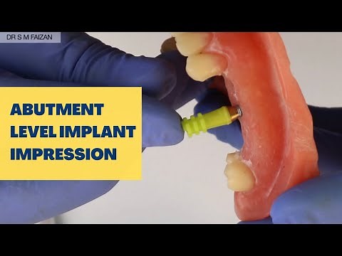 Abutment Level Implant Impression
