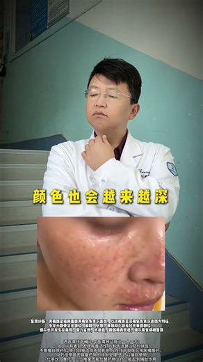 The chloasma that makes you look ten years older actually has these secrets...#spot#Cold f