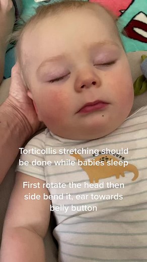 Effective Torticollis Stretches for Babies | Pediatric Physical Therapy
