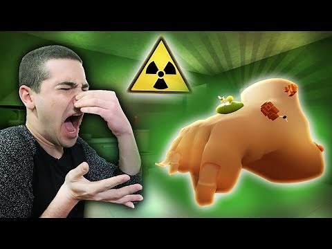 הרגל הכי מסריחה בעולם