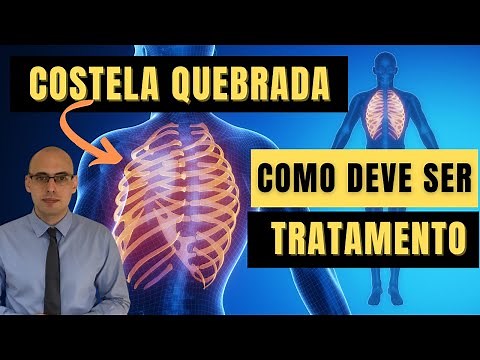 FRATURA DE COSTELA: COMO É O TRATAMENTO? É NORMAL DOER?