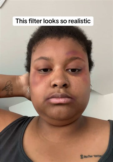 Realistic Bruise Filter Effects for TikTok