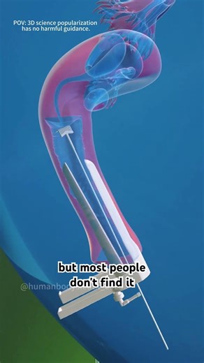 How Pap Smear Test Is Performed (3D Animation) #doctor #nosebyrohrich #3dmedicalanimation
