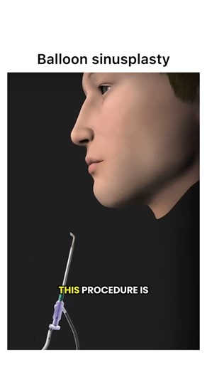 Animations | Follow @surgicalanimation for more! 🏥 | Instagram