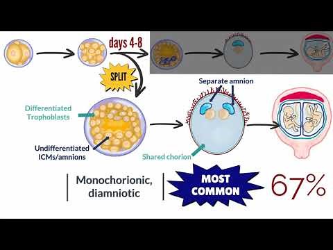 APGO Basic Sciences - Topic 21: Multiple Gestation Pregnancies