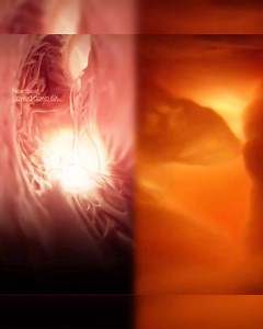 🫀 Tricuspid Valve Mechanics Unveiled! 🫀 Experience the precision of the tricuspid valve’s function in this 3D animation by Hybrid Medical Animation. Observe the intricate interplay of pressure gradients and fluid dynamics as deoxygenated blood flows through the right ventricle. 🩺 This visualization showcases the science of #IntraventricularHemodynamics, highlighting the tricuspid valve’s role in efficient #HeartBloodFlow. Share to spread the knowledge of #CardiacPhysiology! 🔬 #TricuspidValve