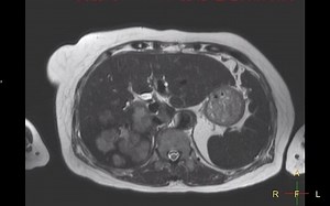 （科研序列）4D MRI