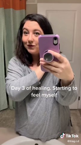 I had a small surgery on Monday to remove some Pilar cysts. I’ve always been very self conscious about them! #insecure #got2bStyled #dermatologist