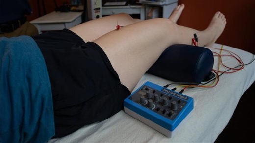 What is Electric Acupuncture? | George Leung, M.Ac, L.Ac, Dipl. Ac, ATC, LAT, PTA, CKTP