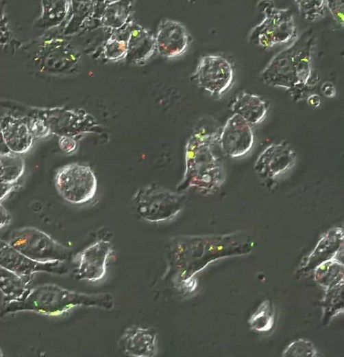 Expression of the AIEC LF82 pathogenicity island allowing iron capture... - Olivier Espeli