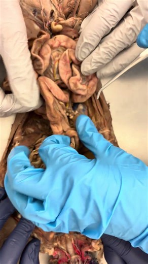 Hepatic Portal Vein