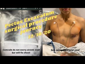 OPERATION NUSS PROCEDURE (Pectus Excavatum Surgery journey/documentary)