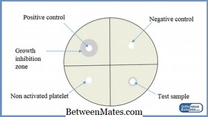 Diferența dintre controlul pozitiv și negativ | Control pozitiv vs. negativ - Educație 2025