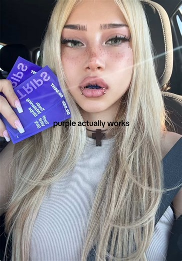 no way ppl are actually mad I’m using whitening strips w braces on MY teeth