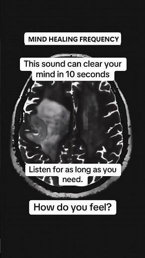 285Hz Healing Tone | Mind Healing Frequency - Instantly Clear Your Mind & Boost Mental Clarity