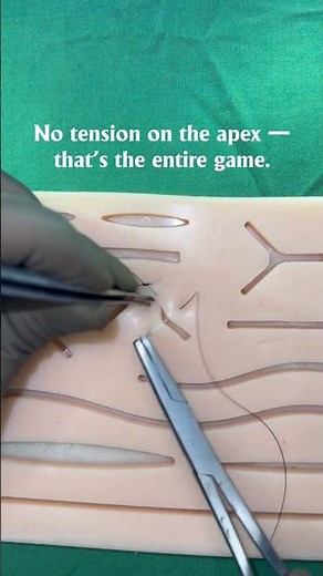 V Wound Closure | Half-Buried Suture Technique #suturing