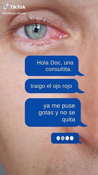 Ojo Rojo: Consulta a un especialista en Oftalmología