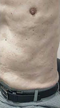 Abnormal apex beat with Hoover's sign in a case of heart failure and COPD