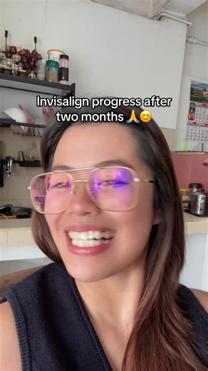 Invisalign Progress After Two Months of Treatment