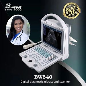[Hot Item] Chinese Manufacturer, Portable Ultrasound Scan Equipment, Ultrasound Scan Machine, Ultrasound
