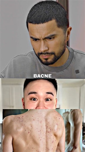 181K views · 2.6K reactions | How To ELIMINATE Back Acne 狼Jose Zuniga reveals if scrubbing in the shower will help remove your body acne. Add this self-care tip to your daily shower routine and get rid of all your body acne fast! #josezuniga #selfcare #shower | Men Style Community | Facebook