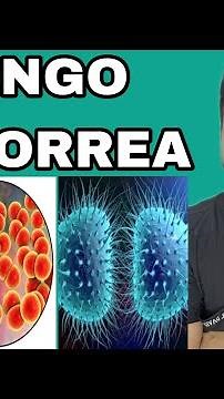 I Have Gonorrhea / How Does Gonorrhea Present? / How Can It Be Treated? | Dr. David Campos