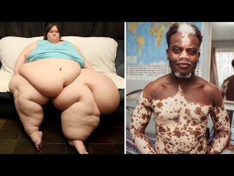 15 Unusual People You Need To See To Believe