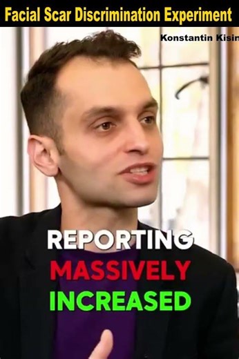 Facial Scar Discrimination Experiment - How Perception Shapes Social Reality