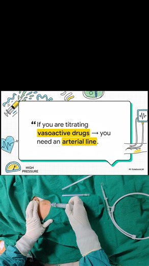 Master class of ICU series - (17th video) 🚨Arterial Line insertion made easy 💉🏥🩺 Life-in-icu👈 follow, Subscribe & DM for personal classes ✨️🏥🩺#drarchanasinha #ventilator #lifeinicu #criticalcare #icudoctor #savealife #stayhealthy #icunurse #MedicalEducation #respiratorytherapist #emergencymedicine #emergencyservices #EmergencyPreparedness #emergencyresponse | Life-in-icu