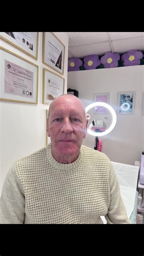 ✨ Client Spotlight – the lovely Brian ✨ Today was all about soft, subtle under-eye refresh for Brian, focusing purely on reducing hollowness and restoring that rested, healthy look — without overdoing it. For this treatment, we used Teosyal Redensity 2, which is beautifully designed for the delicate tear trough area. What I love about this product is its softness and integration — it hydrates, smooths, and brightens without heaviness. No “pumped” look, no harsh edges… just a natural, refreshed u