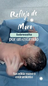 3.8K views · 13 reactions | Reflejo de Moro   También llamado:...