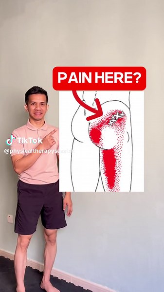 Glutes Pain Relief: Best Stretches for Back and Glute Pain