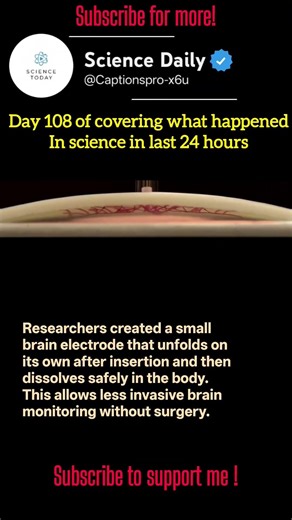 Self-Unfolding Biodegradable Brain Electrode #shorts #science
