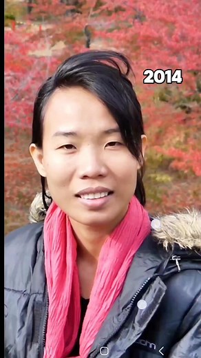 1.1M views · 14K reactions | Yes, you can eliminate hooded eyes naturally. You absolutely don't need Botox, fillers or surgery. Practice daily, take before and after photos, you will see the amazing results 﫶 | Trinh Georg | Facebook