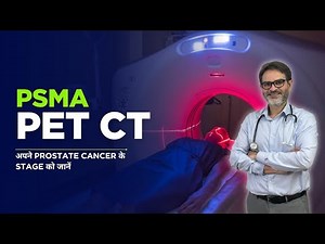 Psma Pet Scan Prostate Cancer Staging and Lutetium therapy | complete details