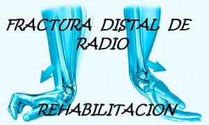 16K views · 92 reactions | Puedes iniciar con ejercicios de estiramiento , movimientos activos de tu muñeca hasta donde toleres. La fractura distal del radio es una fractura común del radio. Debido a su proximidad con la articulación de la muñeca, esta lesión se suele llamar fractura de muñeca. El tratamiento suele ser con la inmovilización, aunque la cirugía es a veces necesaria para las fracturas complejas. | Fisioterapia y Terapia Ocupacional | Facebook