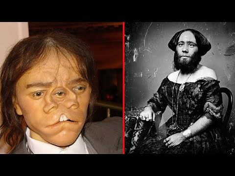 15 Circus Freaks in History That Shocked the World