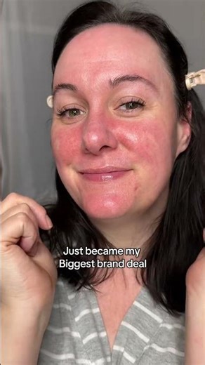 I’m SO excited! Showing up for the rosy cheek girls ! #dreamcomestrue