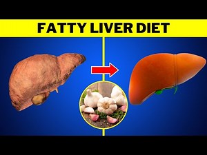 Fatty Liver Diet (5 BEST Foods and 5 To DITCH) Meal Plan