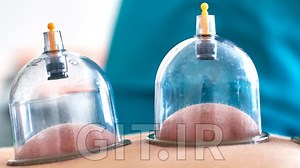 Professional Cupping Therapy Massage Certificate Course 4 CE