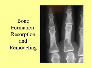 Bone Formation, Resorption and Remodeling - SlideServe