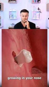 How Teeth Can Grow In Your NOSE! 😳🦷