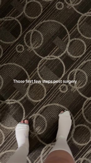 Journey to Recovery After Laparoscopy Surgery