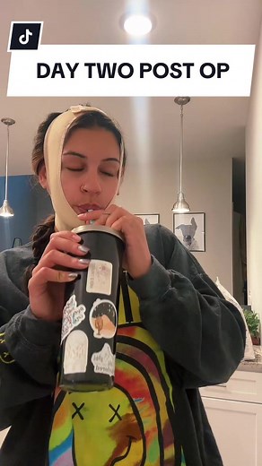 Sleeping Horizontally After Chin Liposuction | Recovery Journey