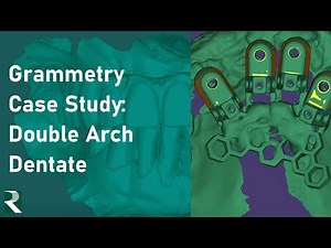Grammetry Case Study: Double Arch Dentate