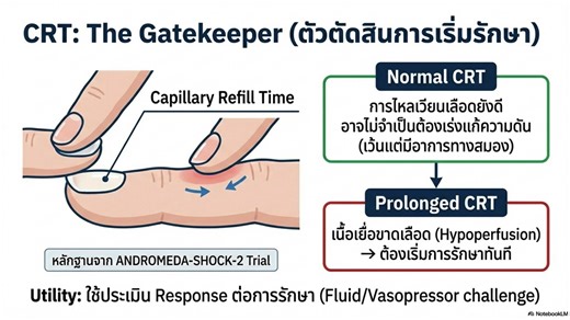 📉 ความดันต่ำใน early sepsis ไม่ได้มีแบบเดียว ถ้าเข้าใจ physiology ตั้งแต่ต้น การกู้ชีพจะ “ตรงจุด” มากขึ้น – Subphenotyping hypotension in early sepsis: A physiology-guided therapeutic approach - อย่ามอง sepsis-induced hypotension เป็นแบบเดียวกันหมด ให้ “แยกชนิด (subphenotype)” ตั้งแต่ช่วงแรกของการ resuscitation แล้วเลือกการรักษาให้ตรงกลไก - ที่ผ่านมาเรามักคุ้นเคยกับ early aggressive fluid เพื่อดัน MAP ให้สูงขึ้น แต่เมื่อข้อมูลมากขึ้นกลับพบว่า → ผู้ป่วย sepsis บางราย ไม่ได้ขาดน้ำเป็นหลัก แต่เกิด