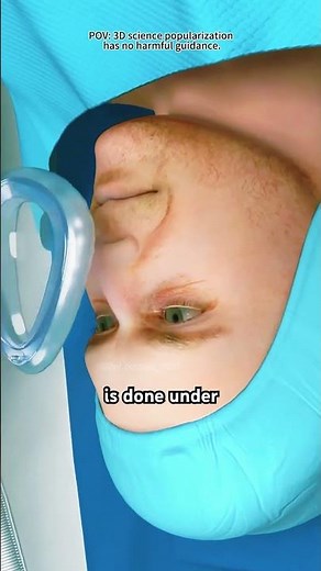 How Arthroscopic Bankart Repair Surgery Is Performed (3D Animation)