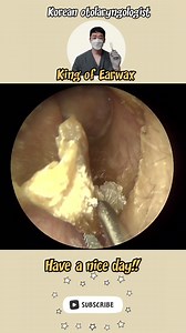 #earwax #earwaxremoval #earcleaning #earwaxextraction #earendoscope | wax jug cleaning