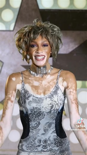 Winnie Harlow as Whitney Houston for one of the most iconic moments in time!!!!!! She nailed it. #whitneyhouston #WinnieHarlow | Spotlight Over The City